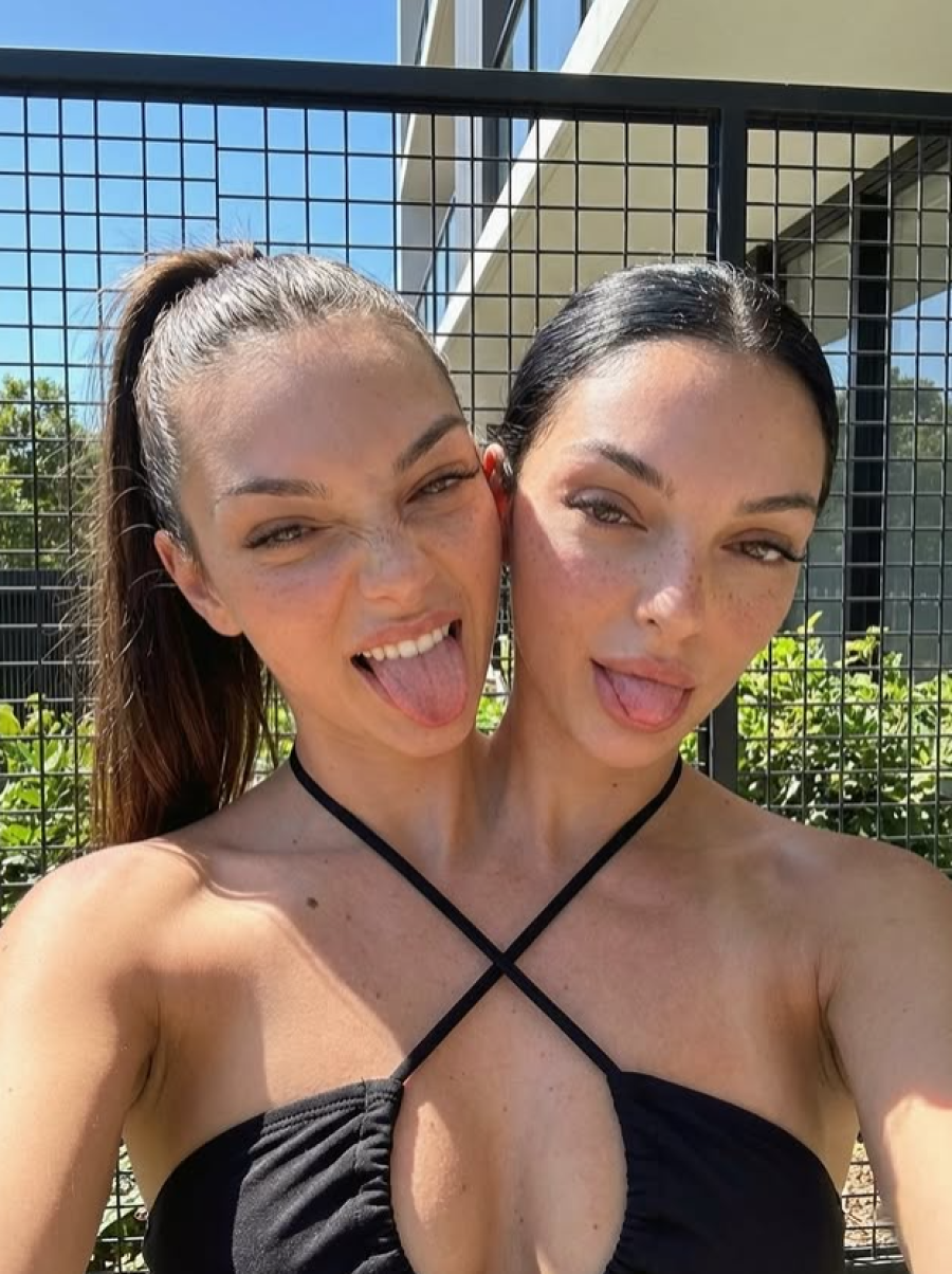 Irmãs gêmeas siamesas viralizam e especialistas descobrem a verdade 