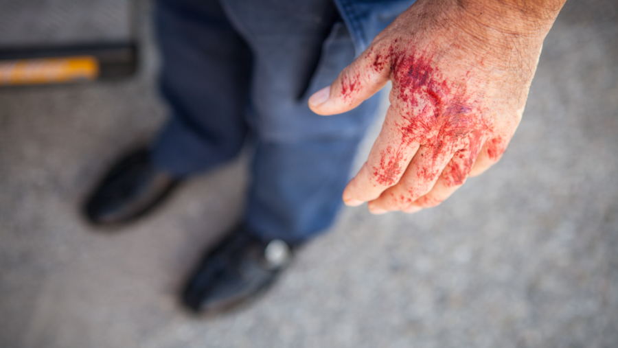 Sorocaba registra múltiplos caso de violência contra mulher em menos de 4 meses