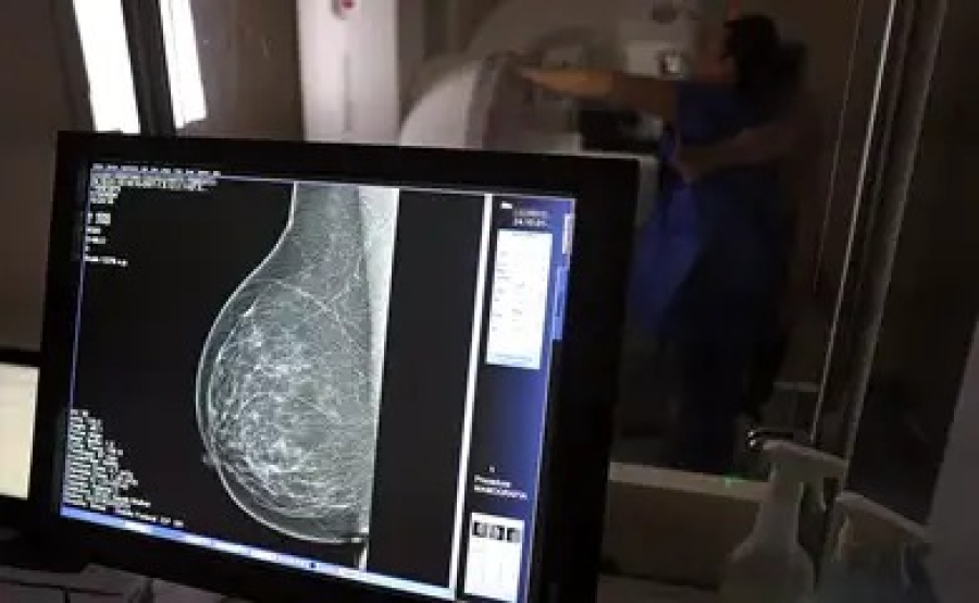 Anvisa aprova novo medicamento oral para câncer de mama